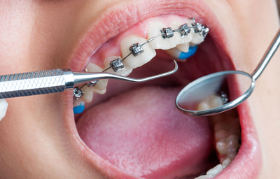 ortho treatemnt